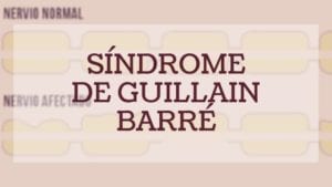 Imagen destacada Síndrome de Guillain Barré