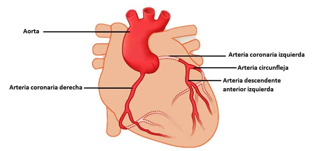 ¿Qué son las cardiopatías isquémicas?